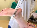 В Челнах ребенок оказался на операционном столе, потому что наступил на осколок стекла