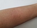 В Челнах мужчина избил и покусал сожительницу