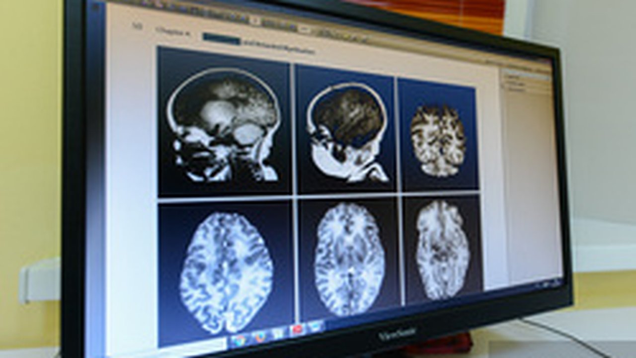 Главная картинка новости: После COVID-19 у пациентов может ухудшиться память