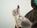 У пациентов с глистами коронавирус протекает легче