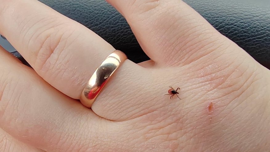 Главная картинка новости: Челнинцев призывают вакцинироваться от клещевого энцефалита