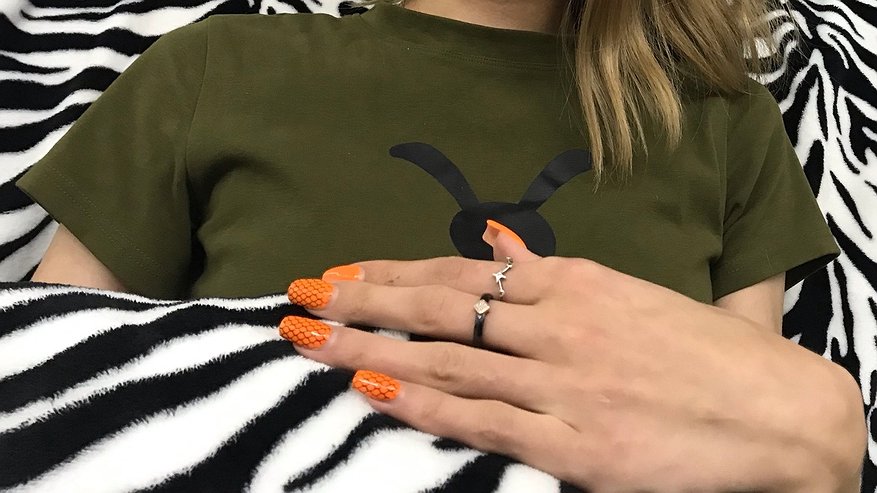 Главная картинка новости: В Казани спасатели дважды за сутки помогли снять застрявшие на пальцах кольца