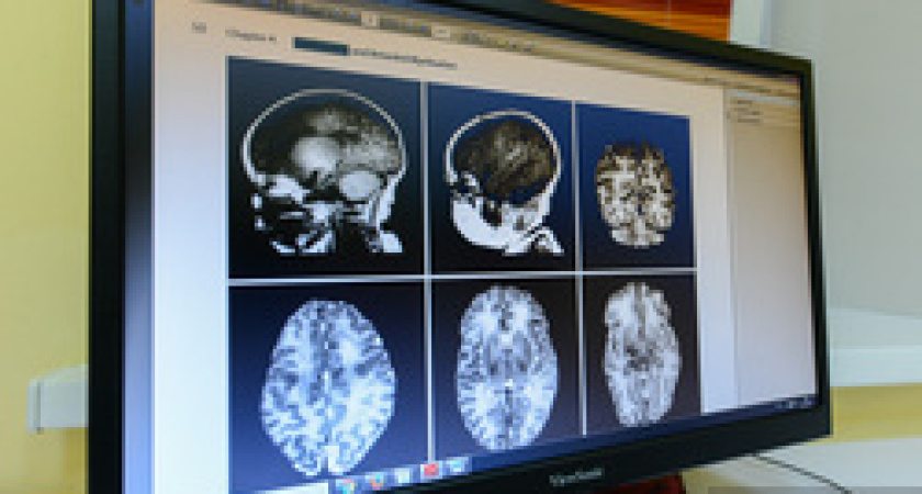 После COVID-19 у пациентов может ухудшиться память