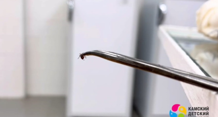 В Челнах в больницу 11 детей обратились с укусами клещей