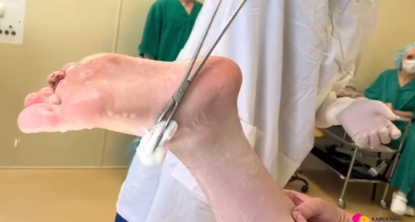 В Челнах ребенок оказался на операционном столе, потому что наступил на осколок стекла